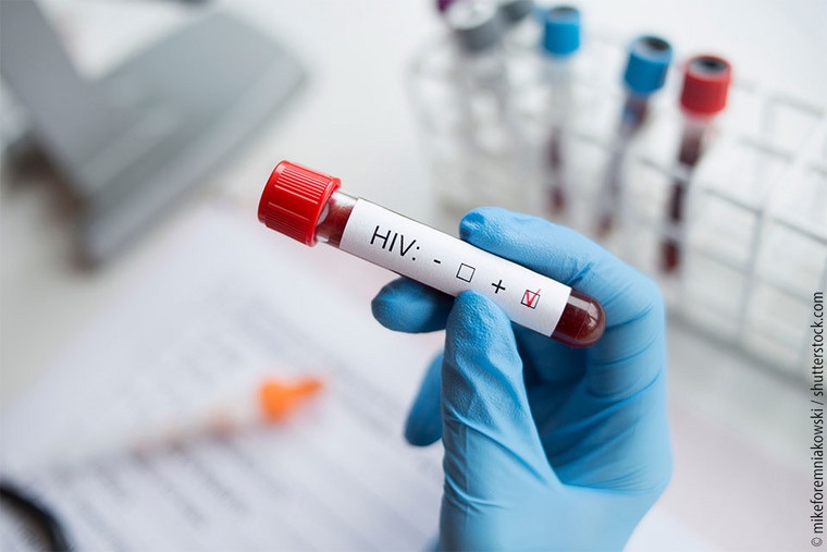Cientistas descobrem anticorpo promissor contra o HIV