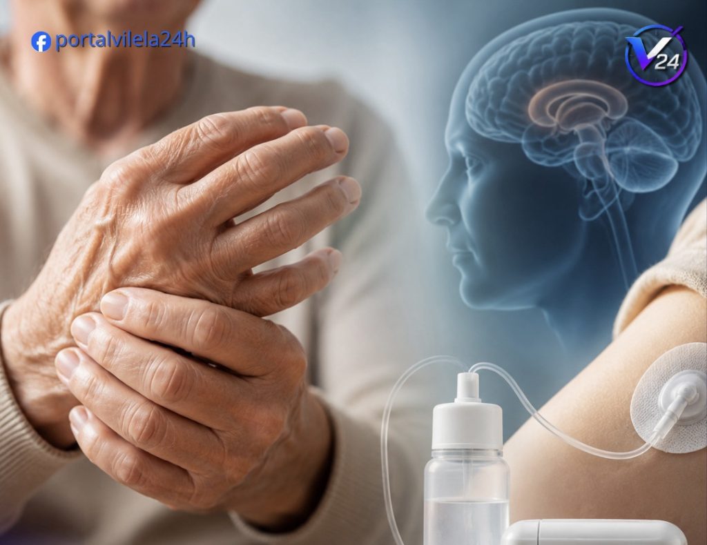 DEPOIS DE 15 ANOS, BRASIL GANHA NOVO TRATAMENTO PARA PACIENTES COM PARKINSON AVANÇADO