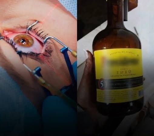 Dois amigos perdem visão e audição após consumo de conhaque na Bahia; suspeita de metanol é descartada