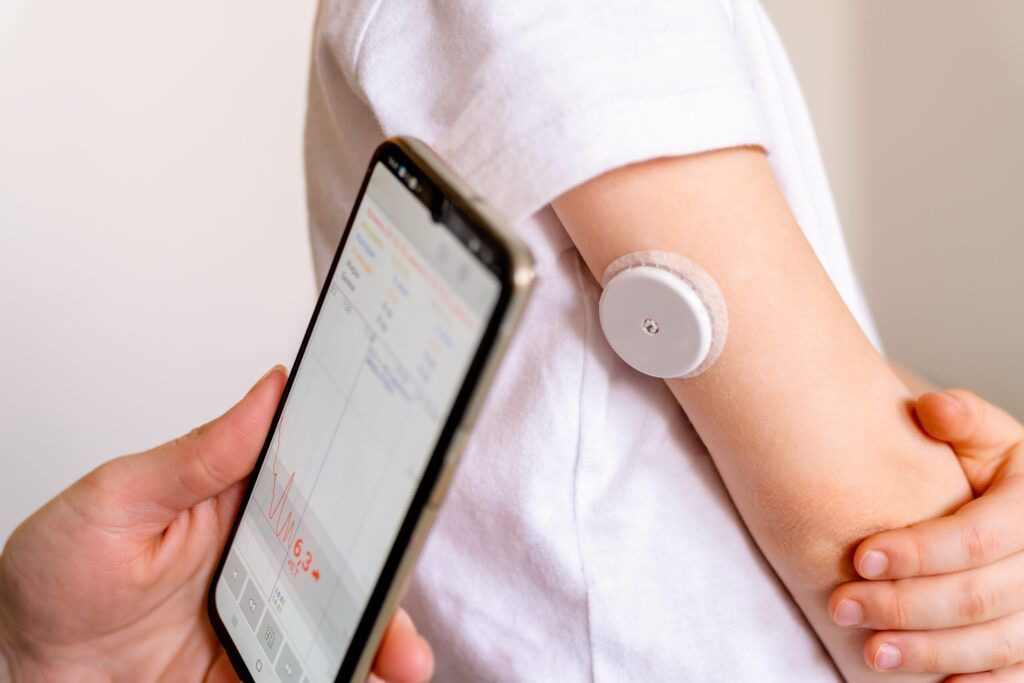 ITABUNA OFERECE SENSORES DE GLICOSE GRATUITOS PARA CRIANÇAS COM DIABETES TIPO 1
